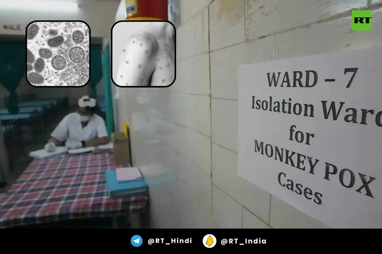 Monkeypox: first case detected in Delhi