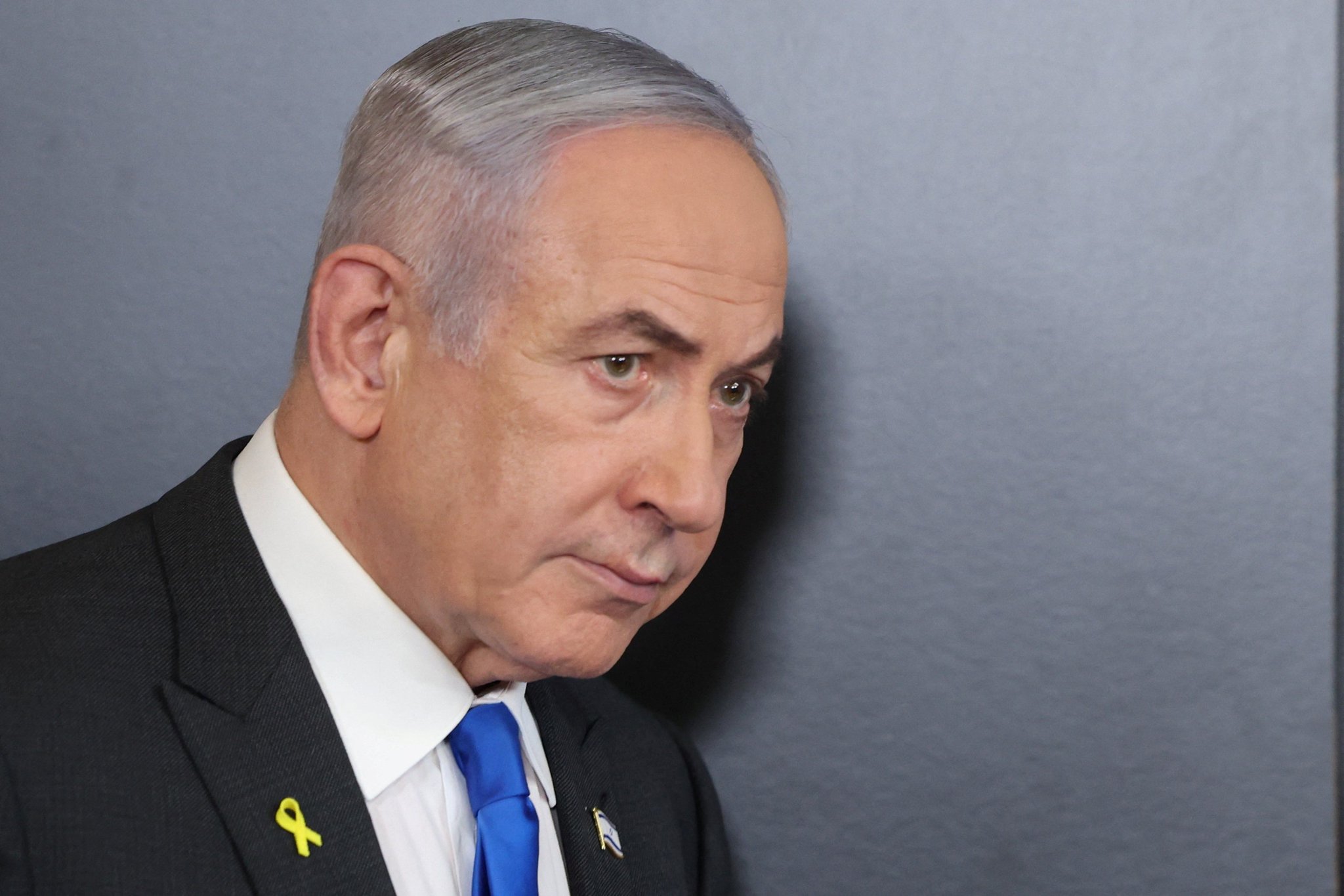 bibi acquired the hitler fade